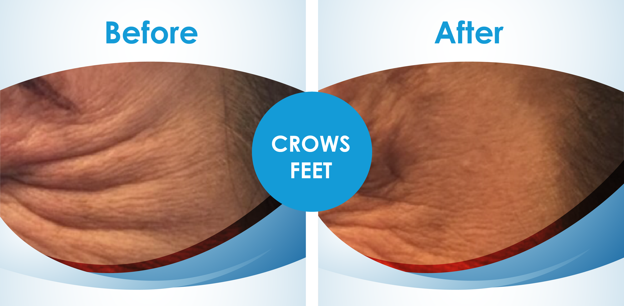 Before and Afters_3.png