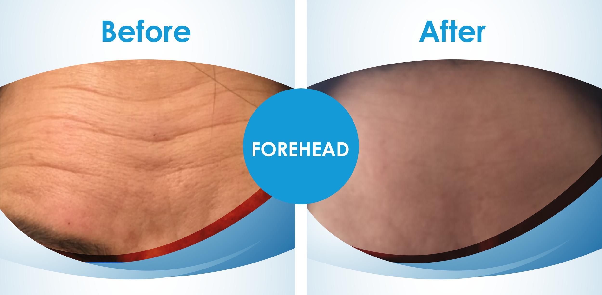 Before and Afters_2.png