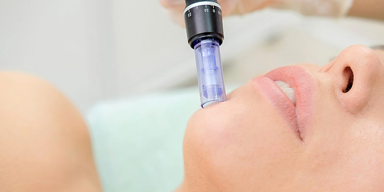 Micro-needling