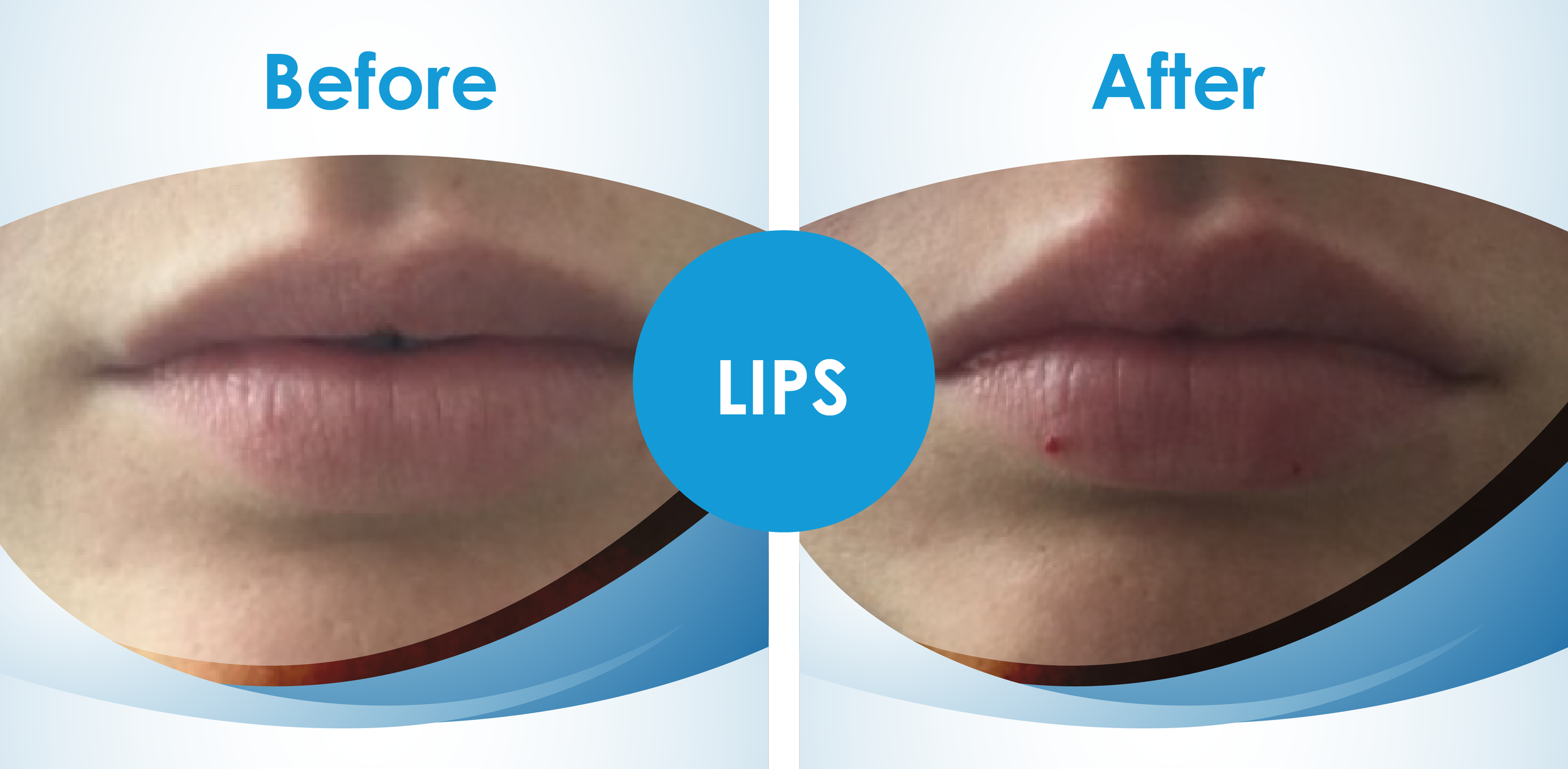 Before and Afters_1.png