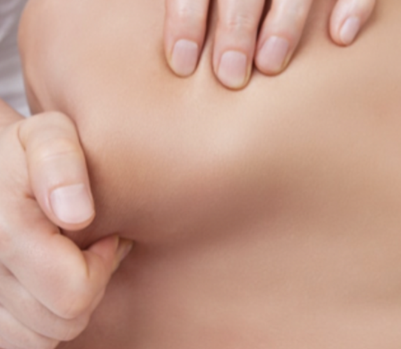 Persoon die op een huid masseert of knijpt.