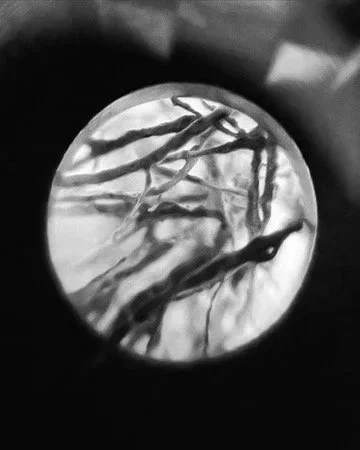 Close-up view of a magnified image showing multiple dark, thin, elongated structures on a light background.