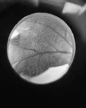 Close-up image of a circular object with intricate textures, possibly a biological or microscopic sample, in black and white.