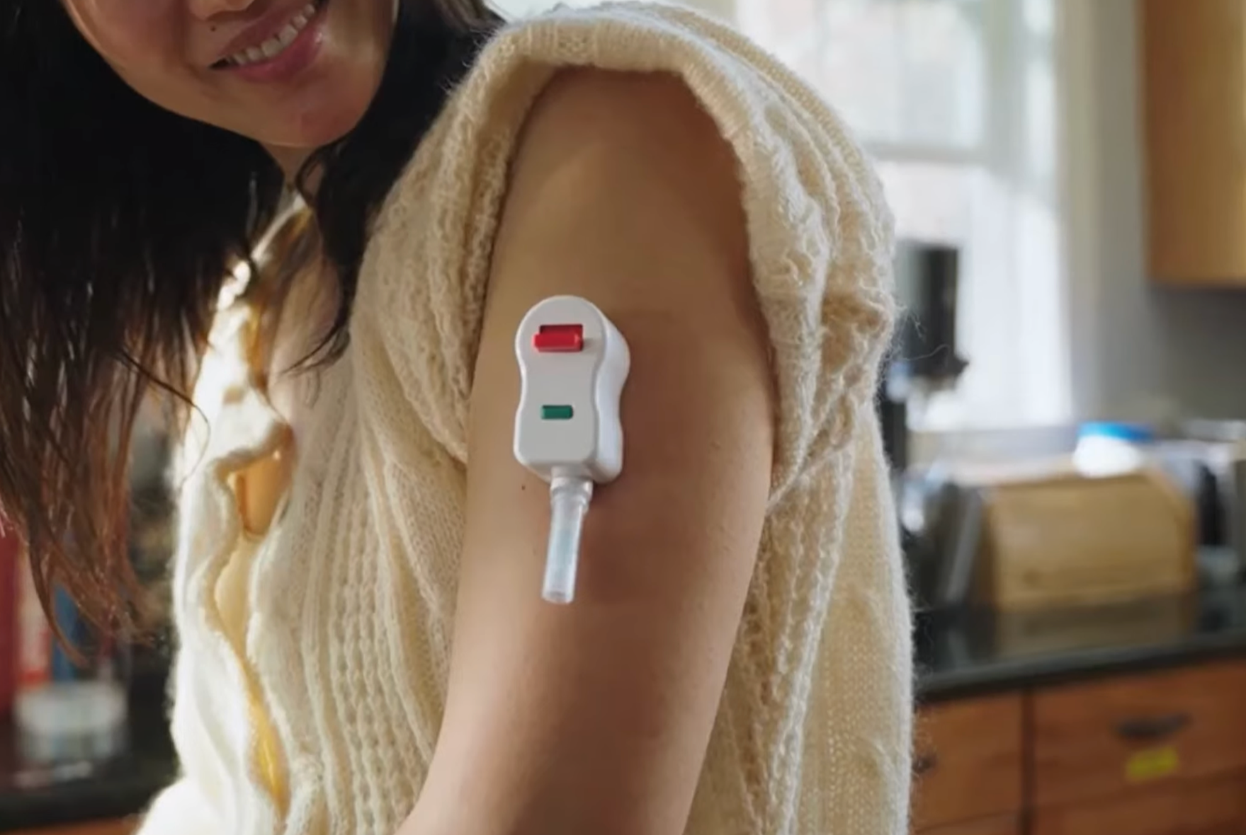 A young woman has a small plastic medical device attached to her upper arm. There are two tabs or buttons on the face of the device and a tube pointing downard.