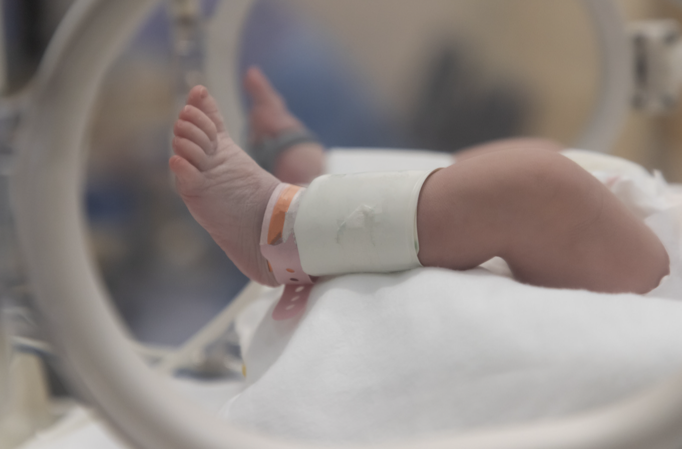 Considerations for NICU babies