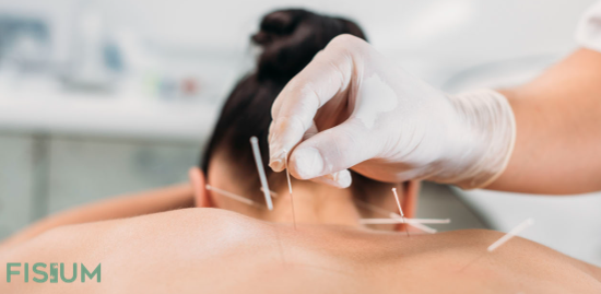 TERAPIA DE PUNCION SECA