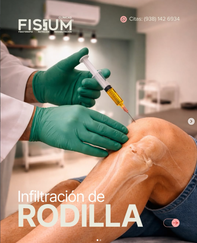 INFILTRACION DE RODILLA CON PLASMA RICO EN PLAQUETAS