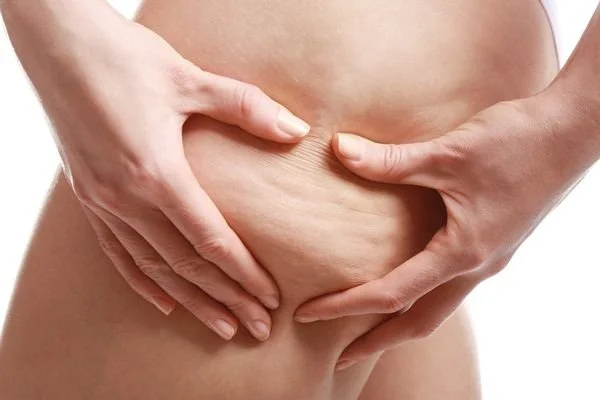 Enciclopedia dei Dubbi | Vol. 4: "Cellulite o Ritenzione? L'errore diagnostico che ti blocca i risultati"