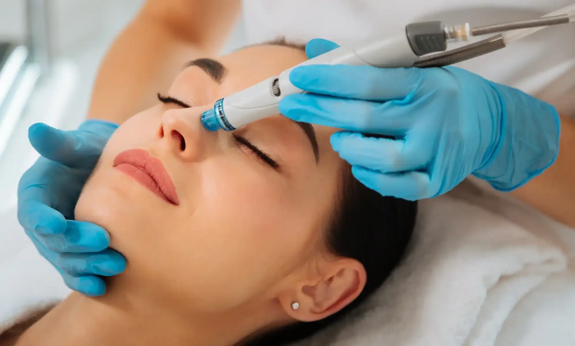 are-hydrafacials-worth-it.webp