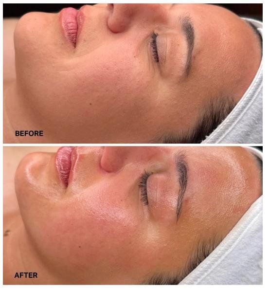 hydrafacial-1.jpg