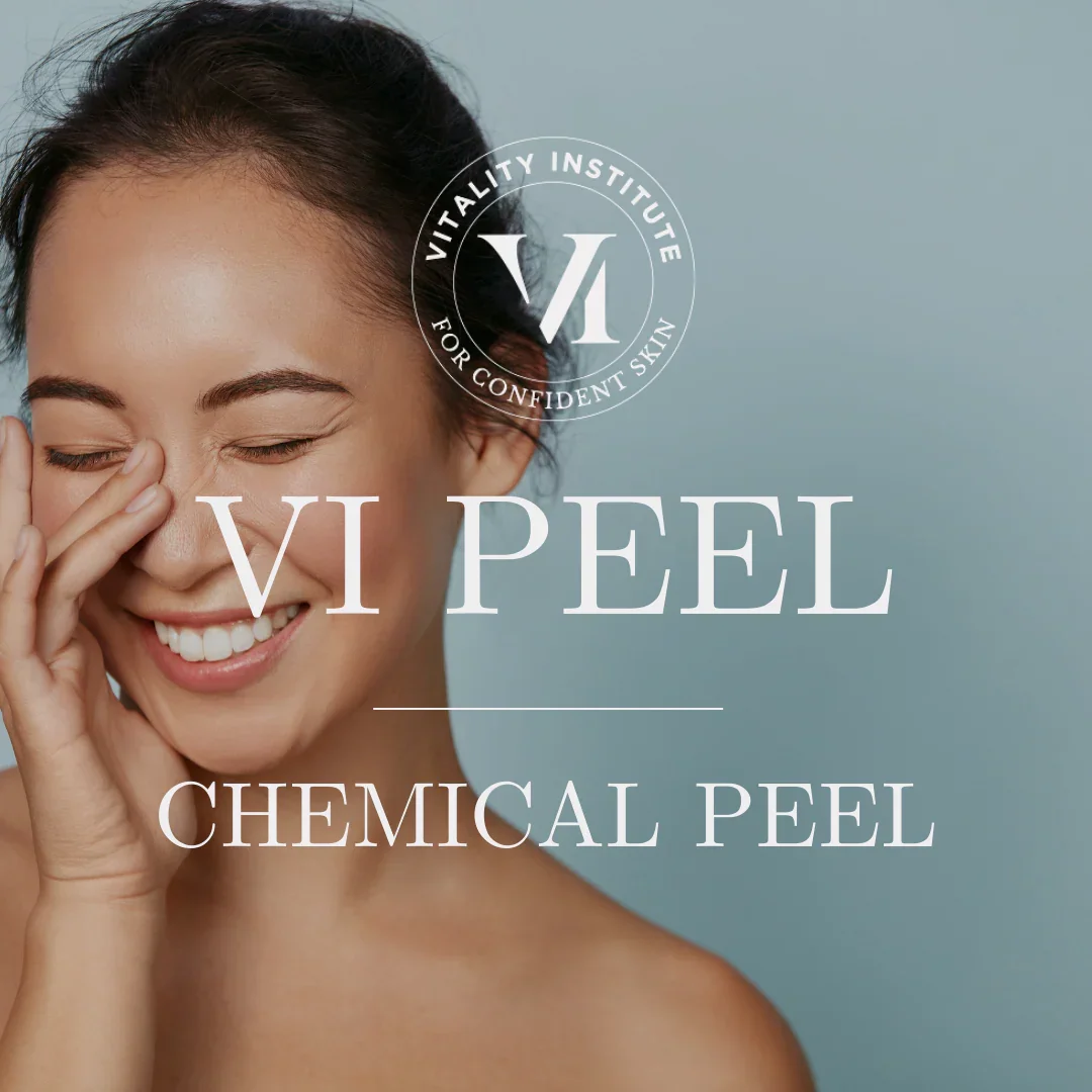 VI Chemical Peels