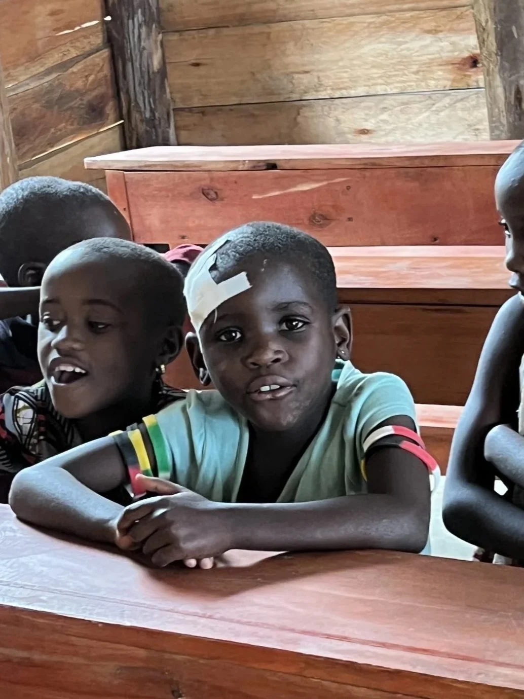 Batwa boy sitting at desk with head bandaged at the Heart 2 Heart Primary School in Uganda, Africa