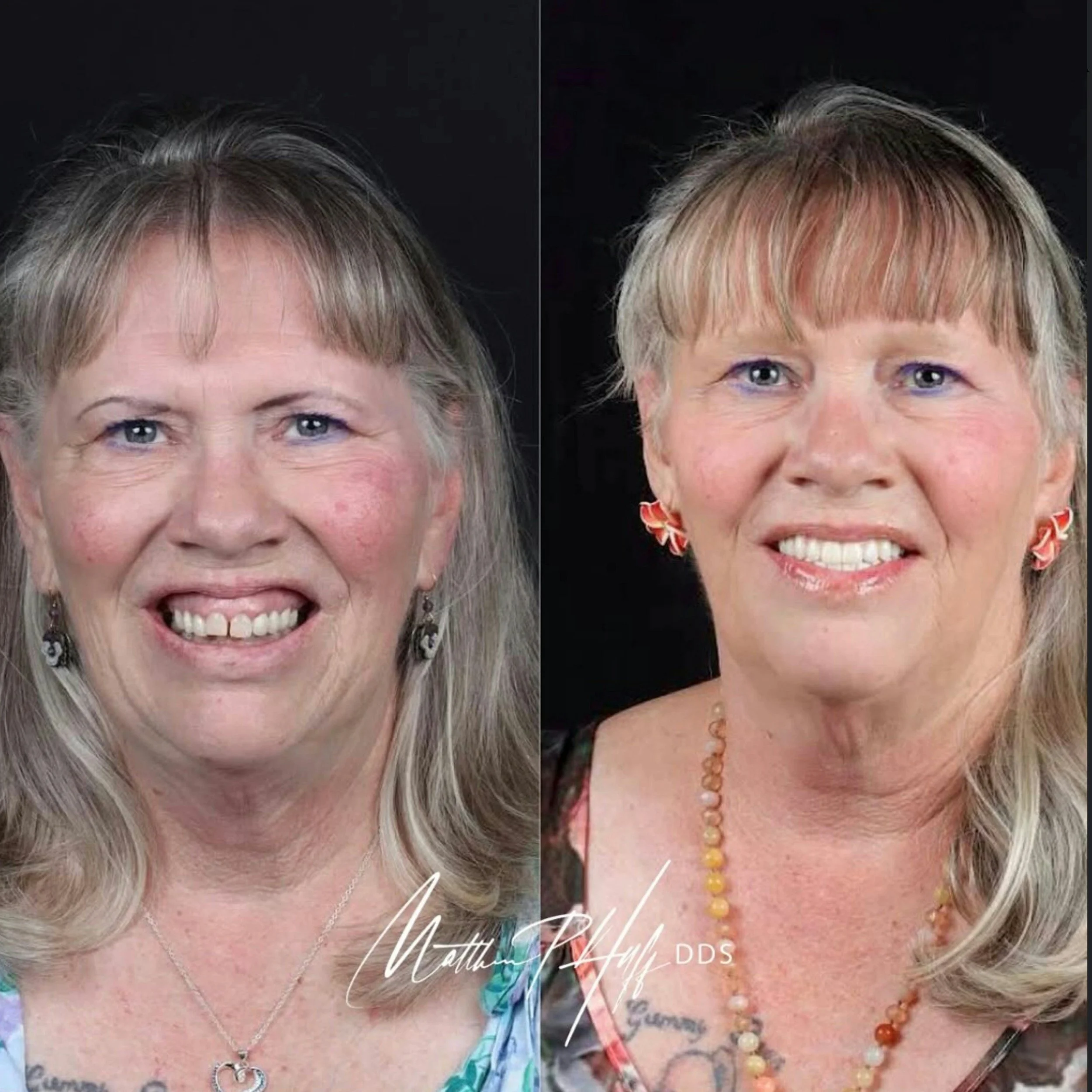 Why Some People Look Younger Than Others