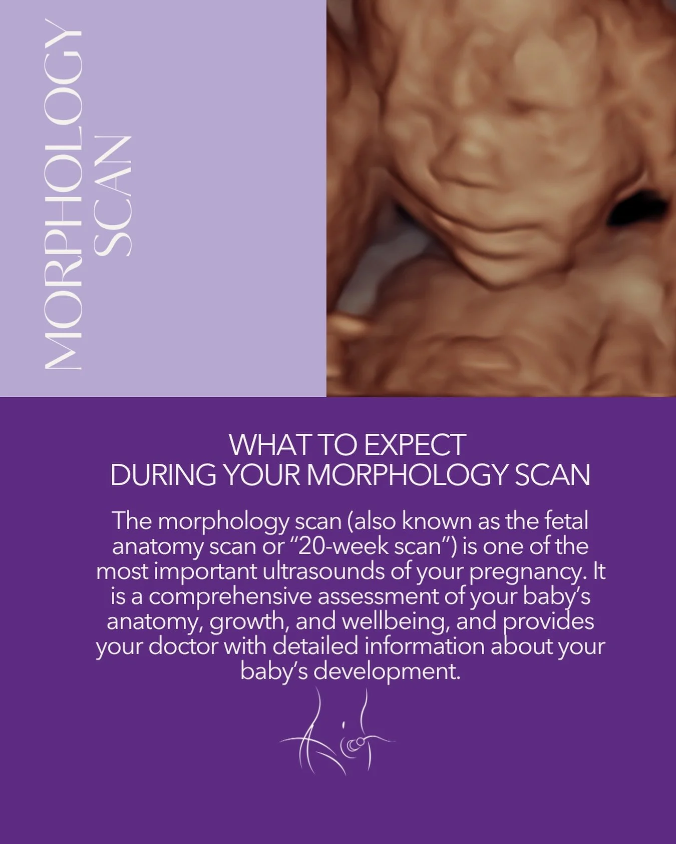 The 20 week scan is the big one! This is a very detailed check of all of your babies anatomy. This is such a fun scan, where your baby starts to look more and more like a tiny human! We also check the placenta, your cervix and ovaries. 💜#pregnancyul