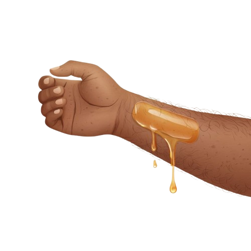 A human arm with a bandage and blood dripping from a wound.