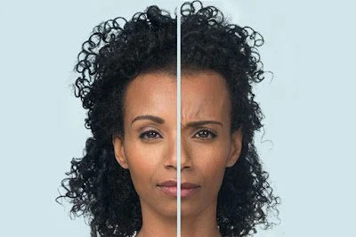 Botox Injections: Purpose, Side Effects &amp; Warnings