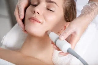 Cosmetic Laser Treatments