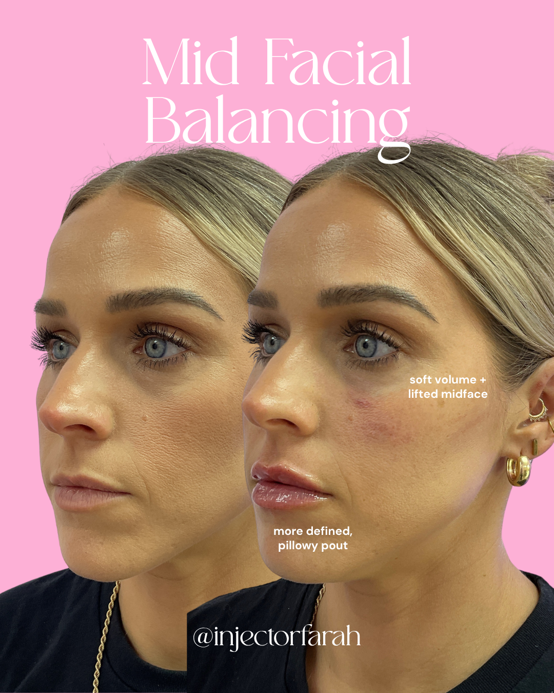 0427_FACIALBALANCING_C1.png
