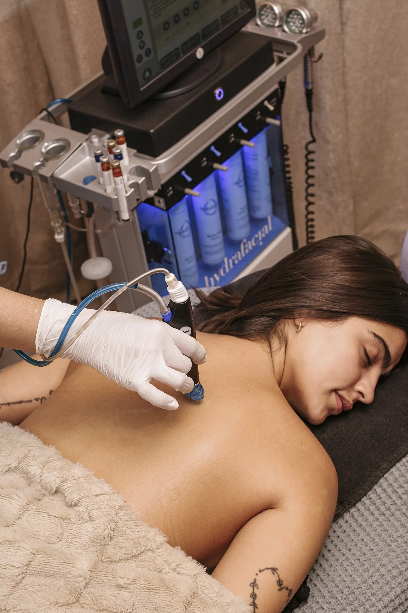 Una mujer recibiendo un tratamiento estético en la espalda con un dispositivo de terapia de plasma en un entorno clínico, con un equipo médico y máquinas en el fondo.