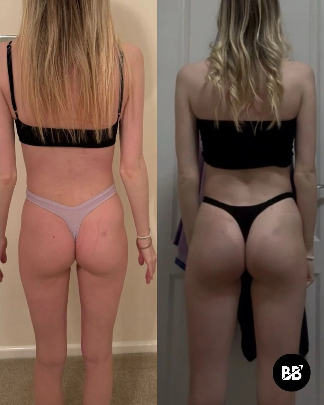 Women's fat loss results at Become Bodywise Daventry