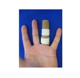 Pulley Reconstruction