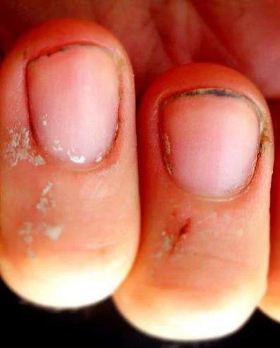 Operation Preparation