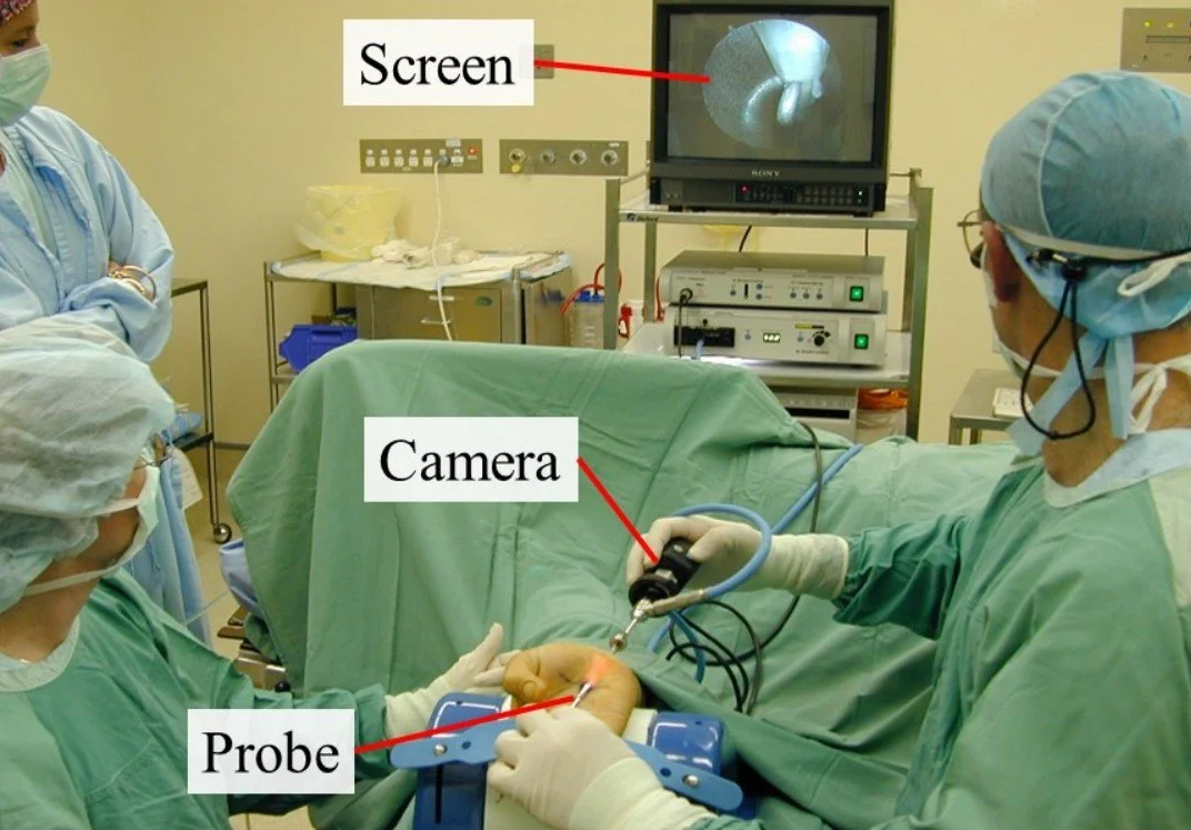 ECTR Surgical Technique