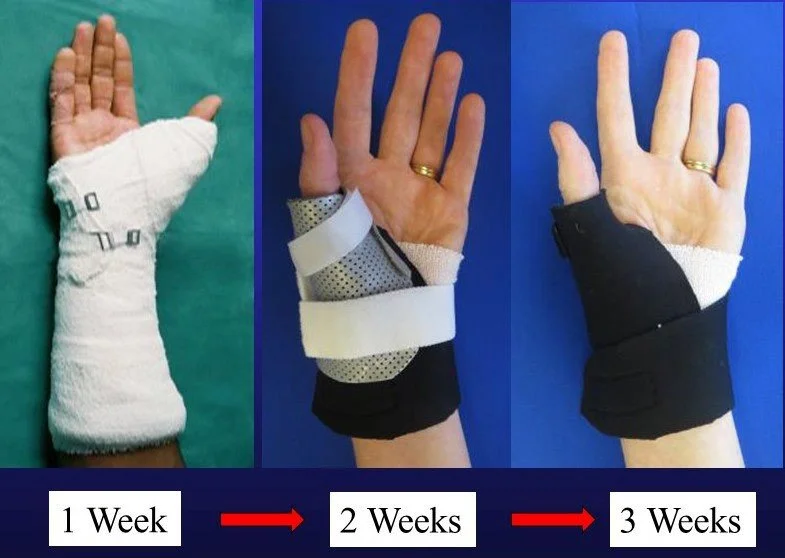FCR Interposition - Post Op