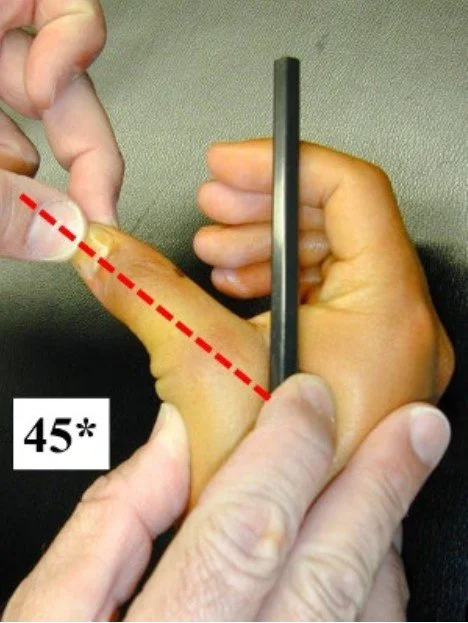 Skiers Thumb Classification
