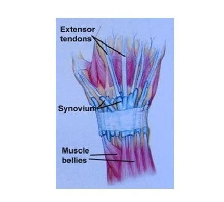 Extensor Tendon Injuries