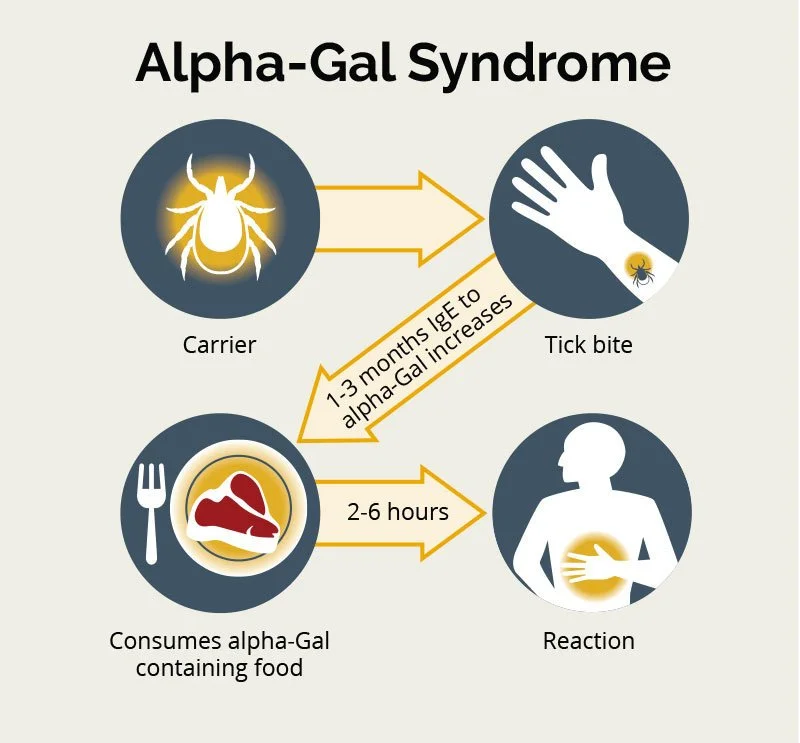 AP News: What to Know About Alpha-gal Syndrome
