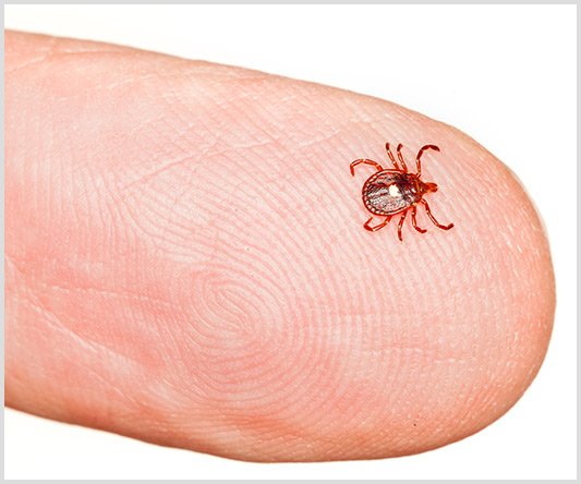 NPR: A Tick-filled Odyssey