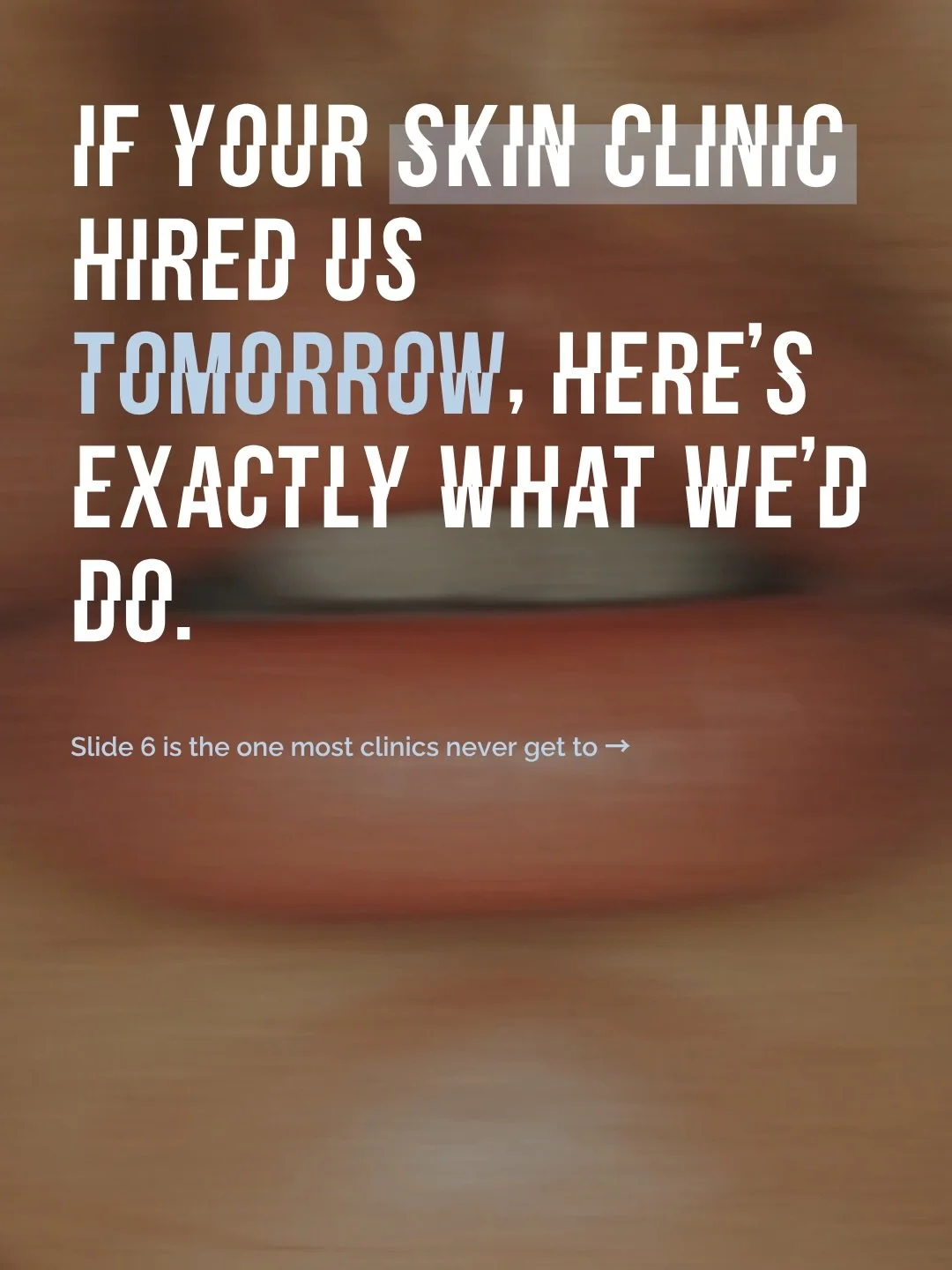 If a skin clinic hired us tomorrow, we&rsquo;d start with a diagnosis, six things checked in the same order every time, before we touch a single post.⁠
⁠
Slide 6 is the one worth sitting with. Most clinics have gaps somewhere, in the calendar, the tr