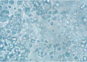 Estudio Mora therapy: Diagnostico cancer