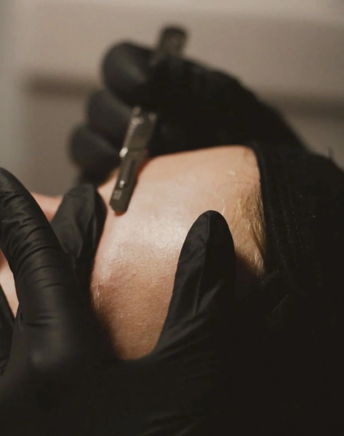 Dermaplaning