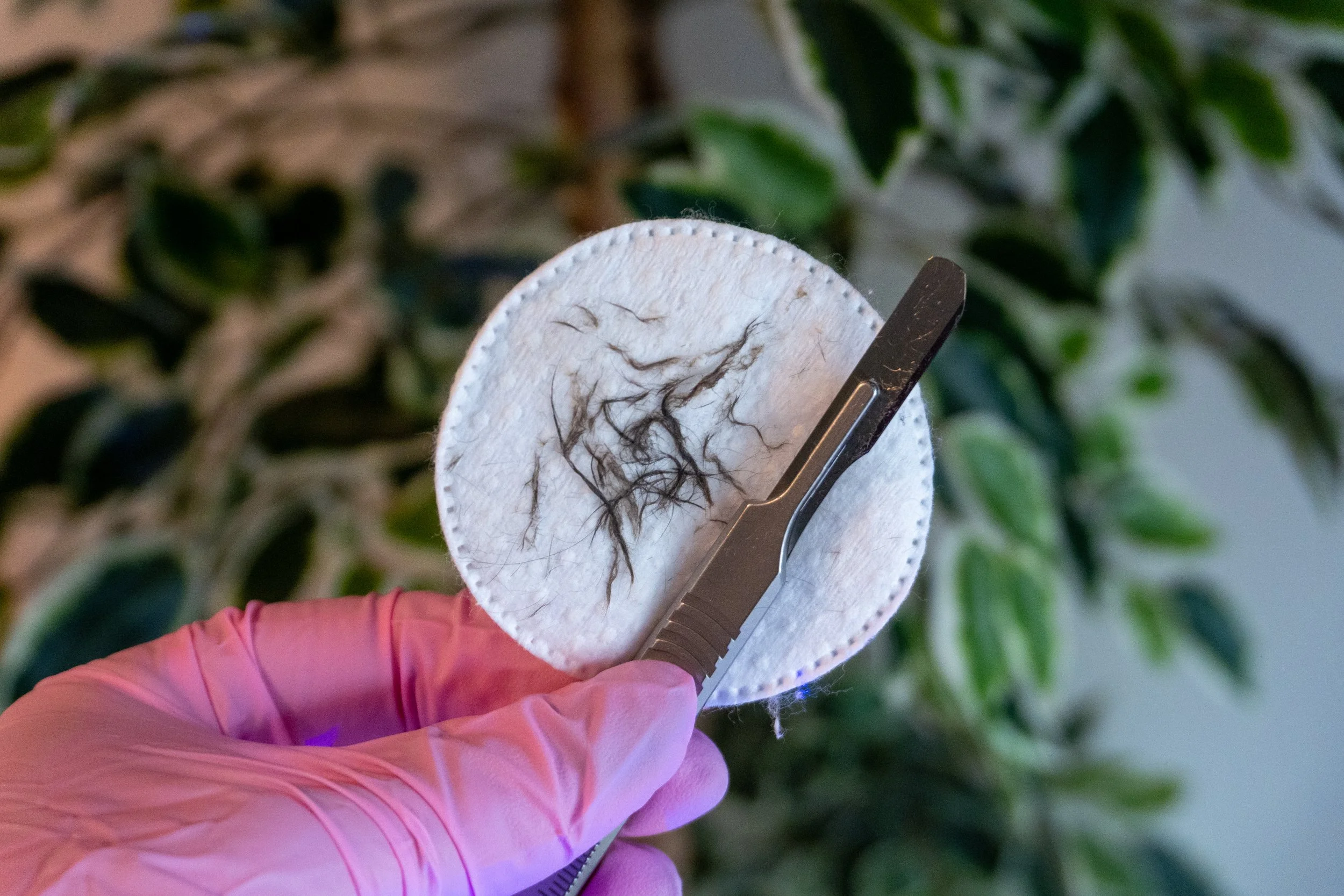 Is Dermaplaning Safe for Your Skin?  Contraindications Explained 