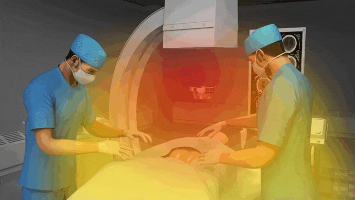 Secondary Exposure by Scattering rays that bounce off the patient's body or objects.