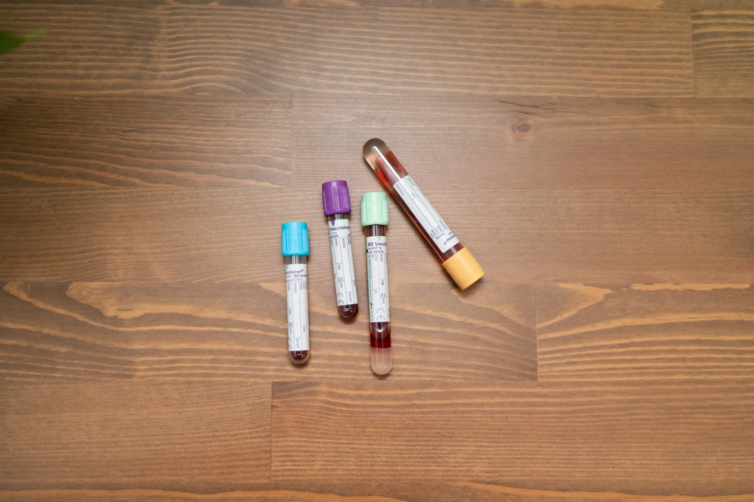 Why Your Blood Tests Are “Normal” but You Still Feel Inflamed