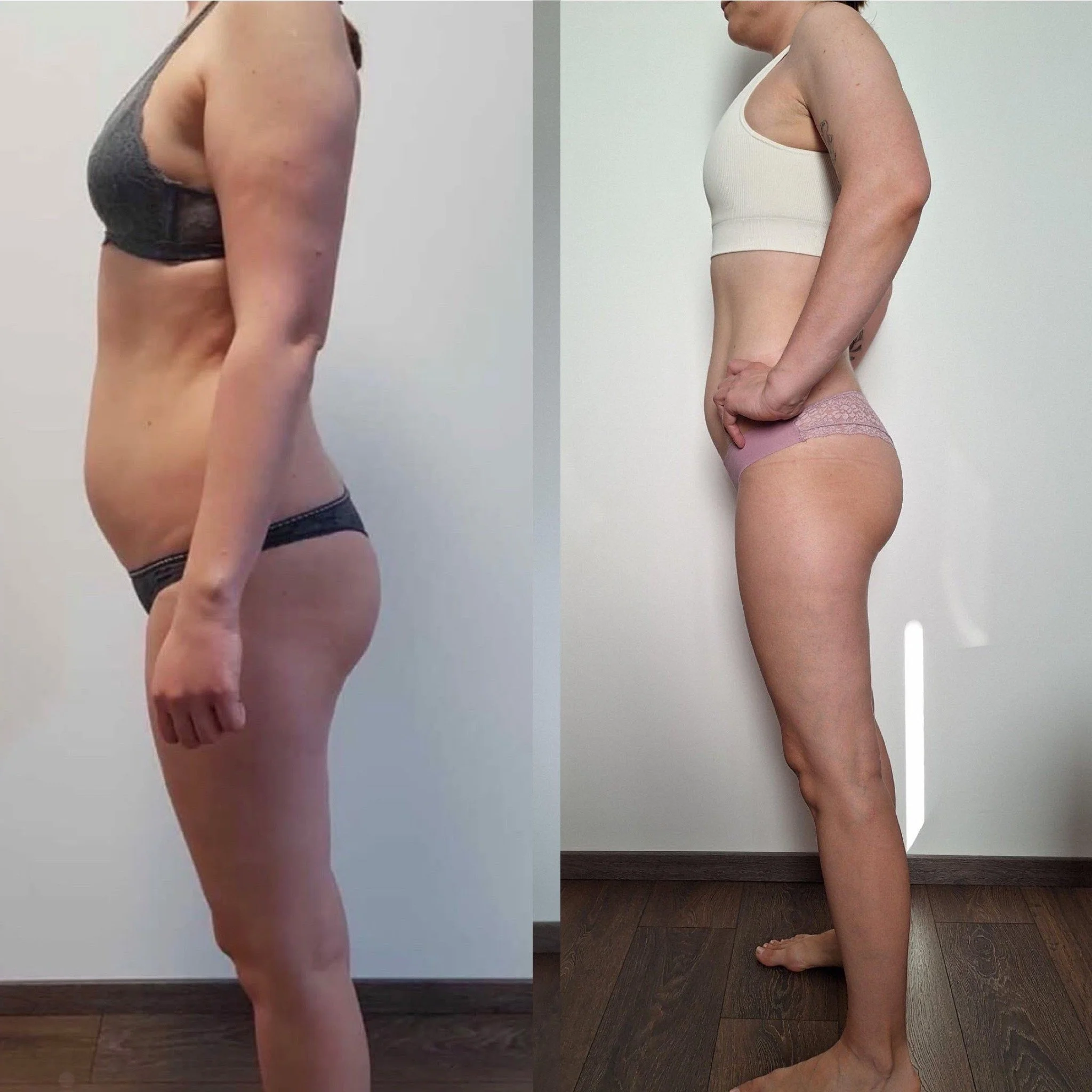 Side view of a woman before and after body transformation, showing her torso and legs in underwear, with the left side appearing heavier and the right side appearing slimmer.