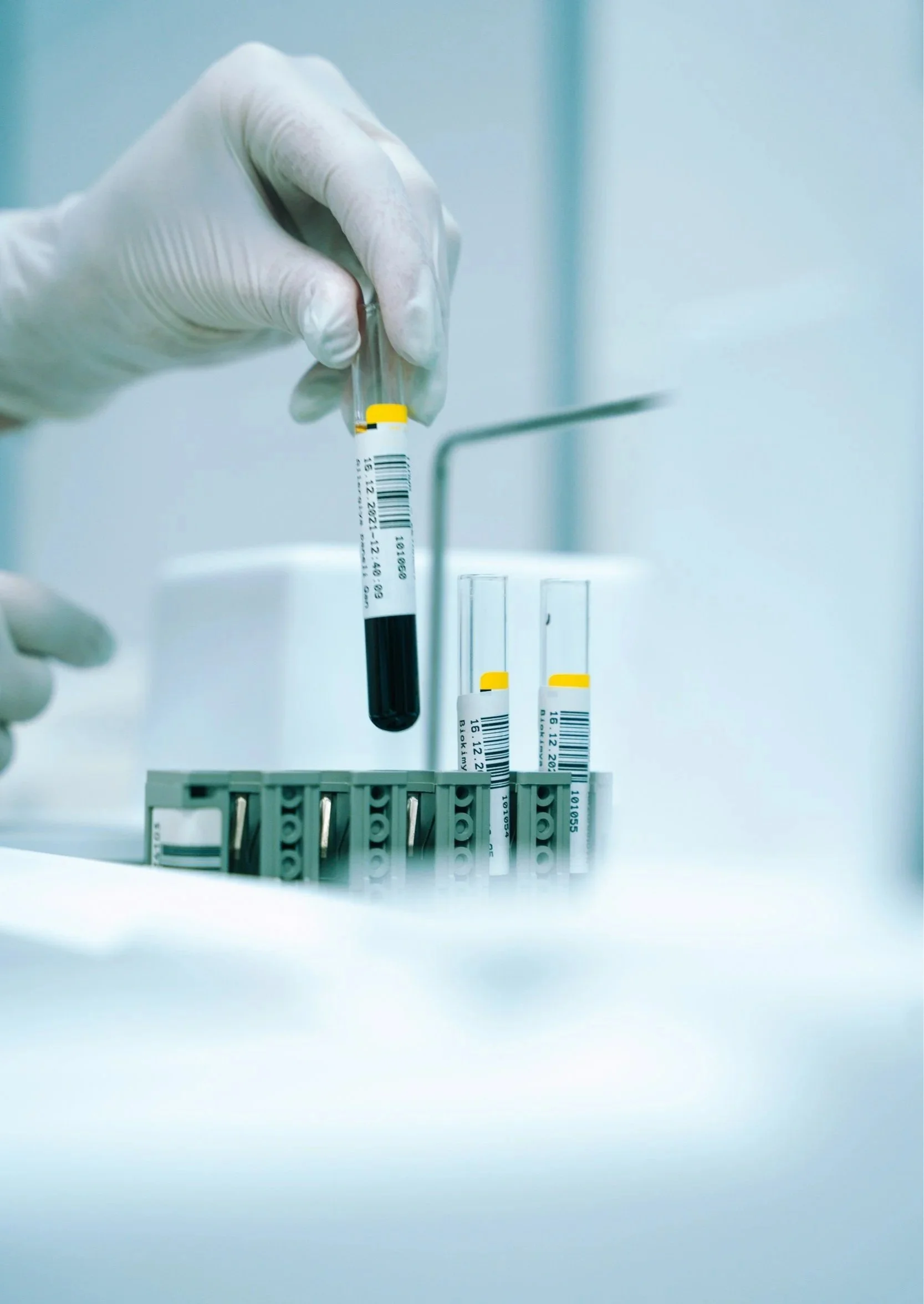 A gloved hand holding a test tube filled with blood, with additional test tubes in a rack.