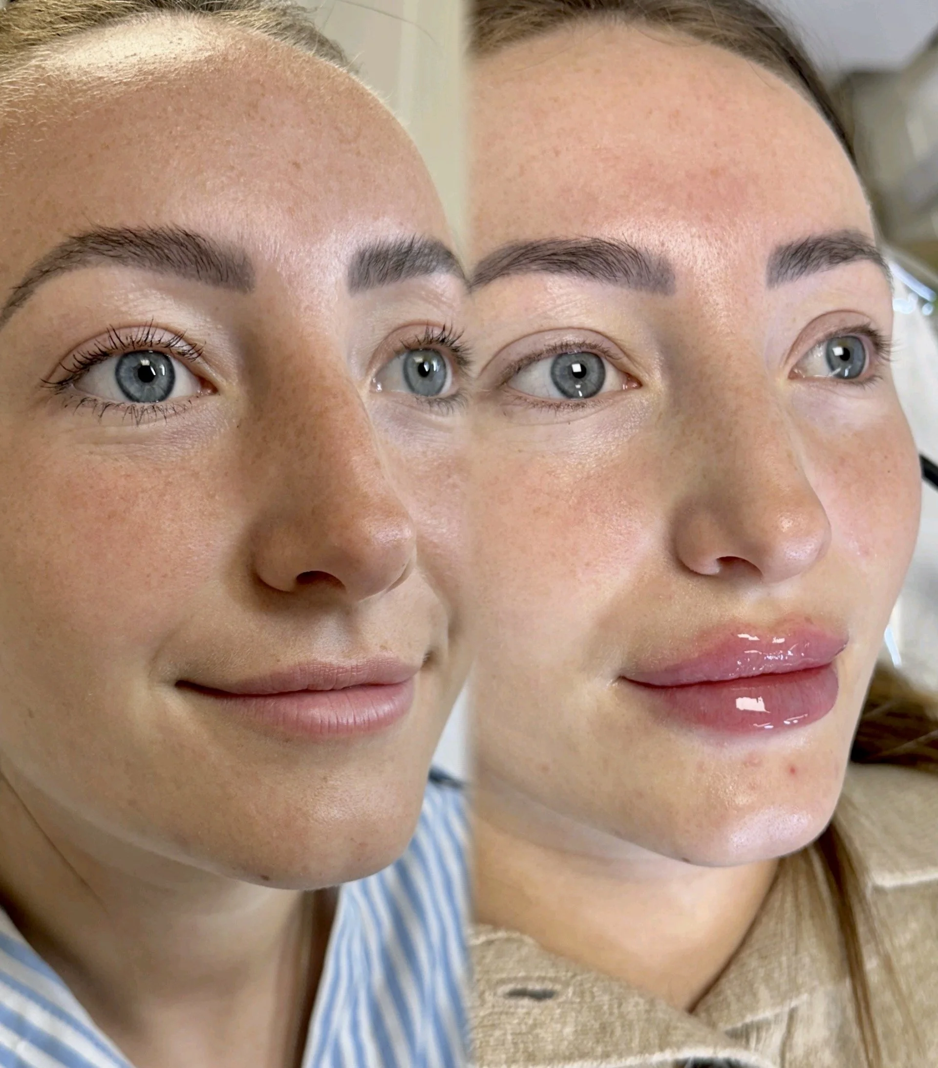Close-up of two women with clear skin and brown eyebrows, one with blue eyes and the other with hazel eyes, showing before and after images of lip gloss application.