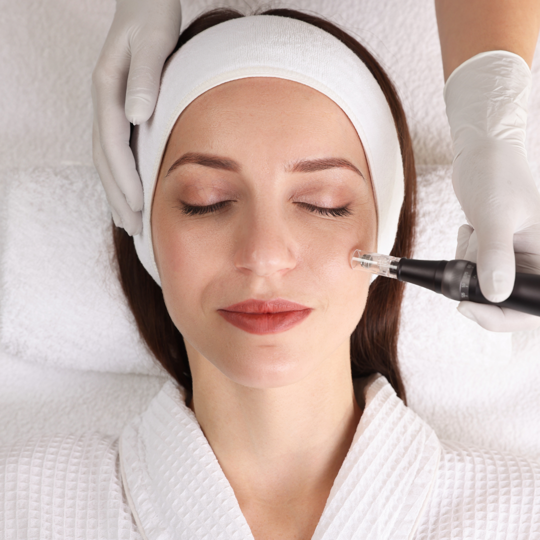 Medspa in San Antonio, TX 78259 l Microneedling Near Me