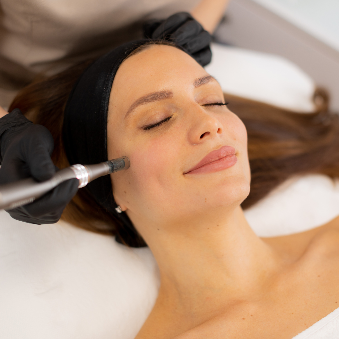 Medspa in Morgan Hill, CA 95037 l Microneedling Near Me