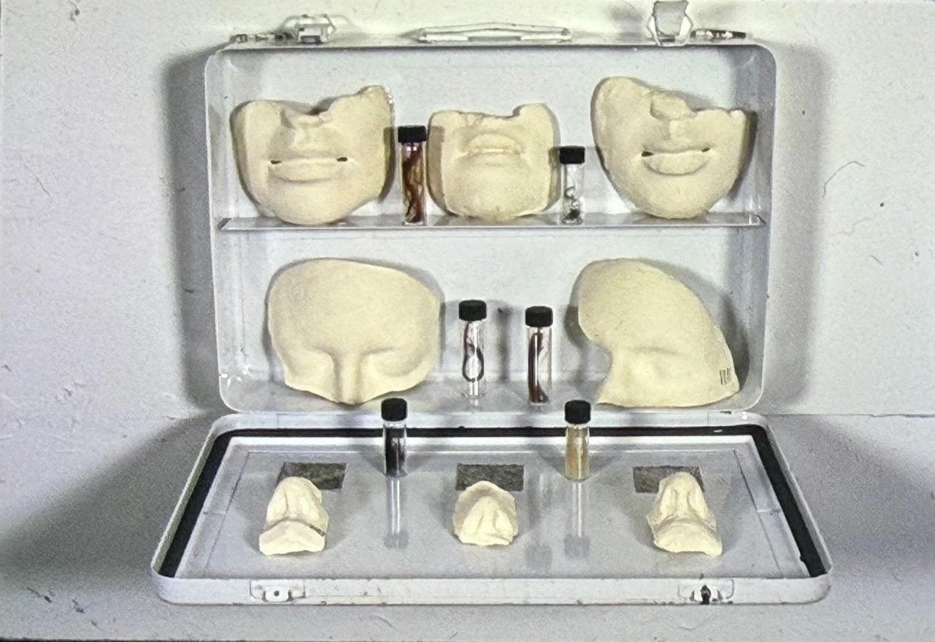 Open metal case displaying plaster life-cast facial fragments, including masks, cranial sections, and nose casts, arranged alongside small specimen vials full of wheat.