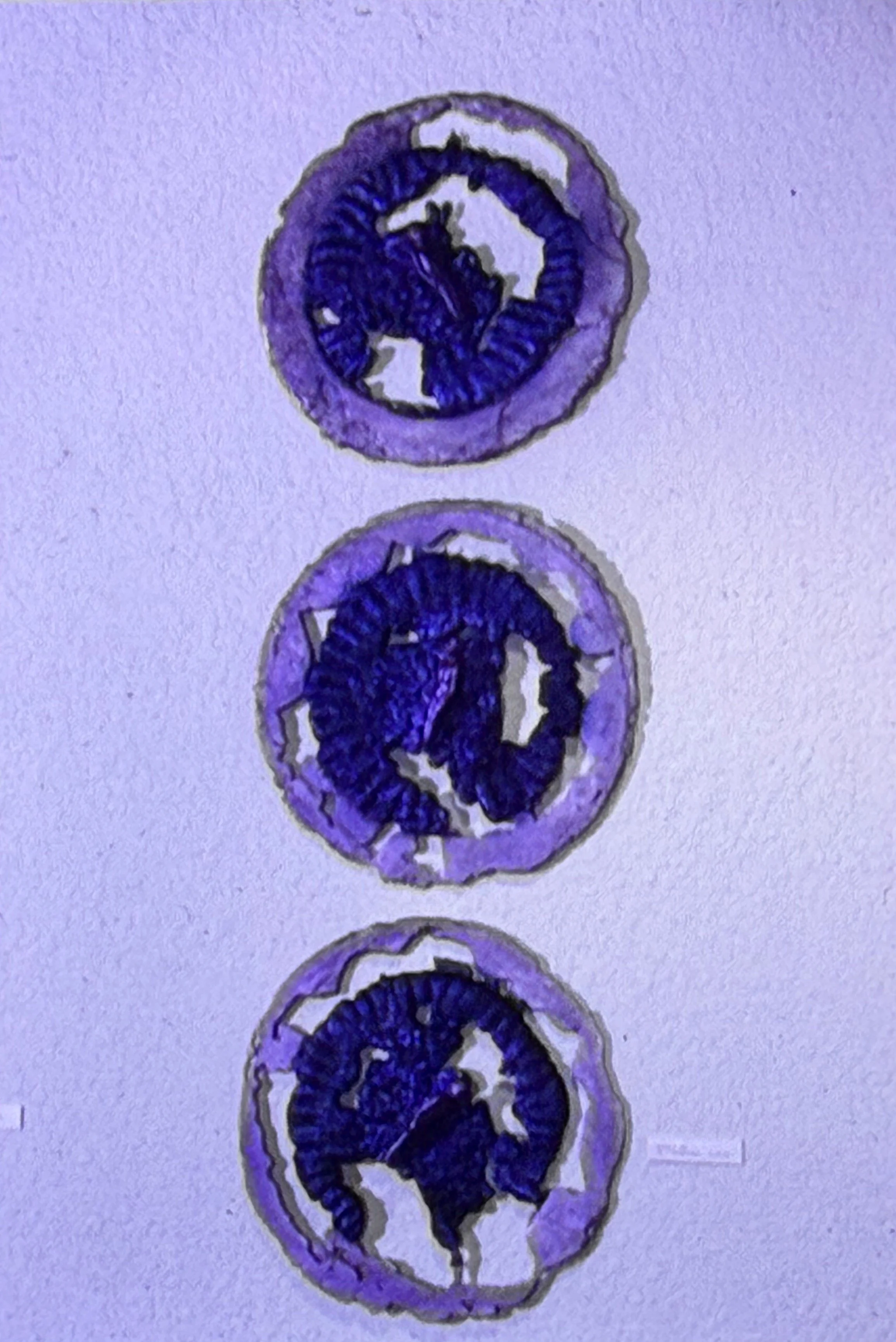 Vertical arrangement of three circular relief works featuring purple and white organic patterns.