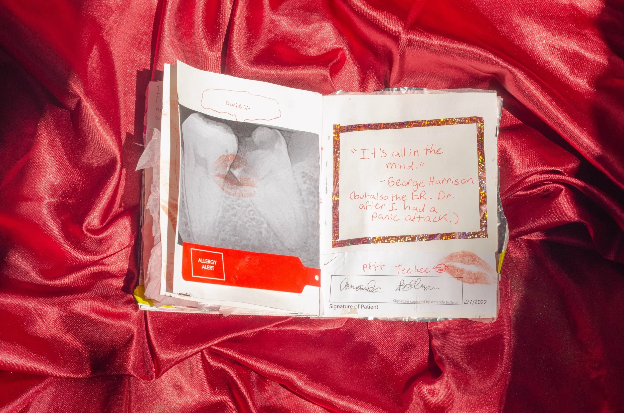 Open journal or scrapbook on red satin background, with handwritten notes, lipstick kiss, and allergy alert sticker visible.