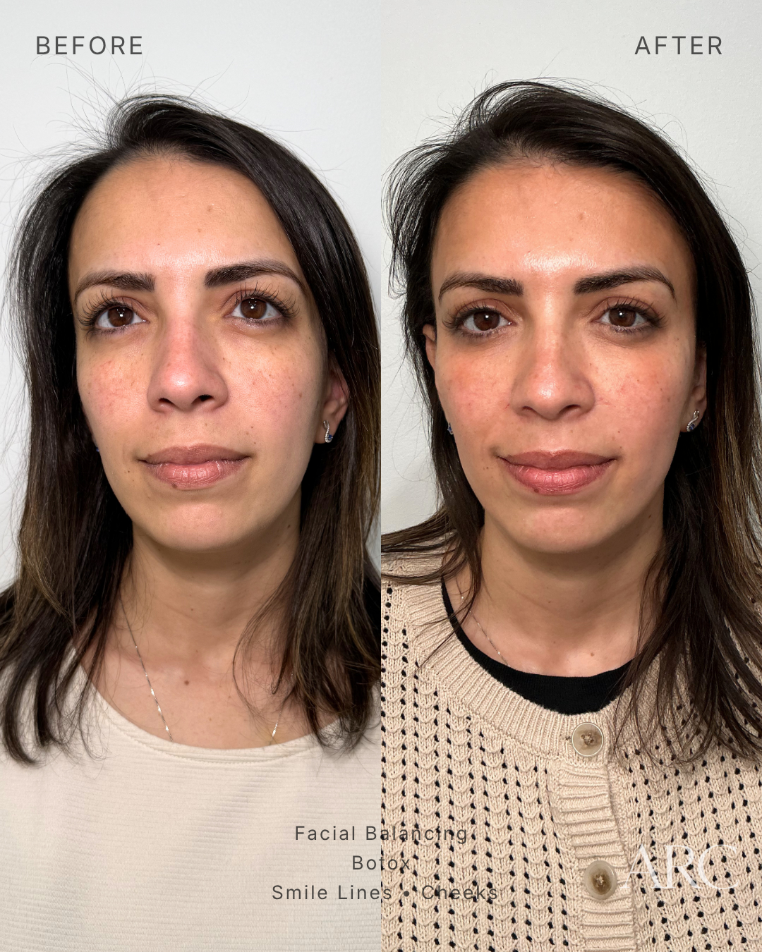 Facial Balancing