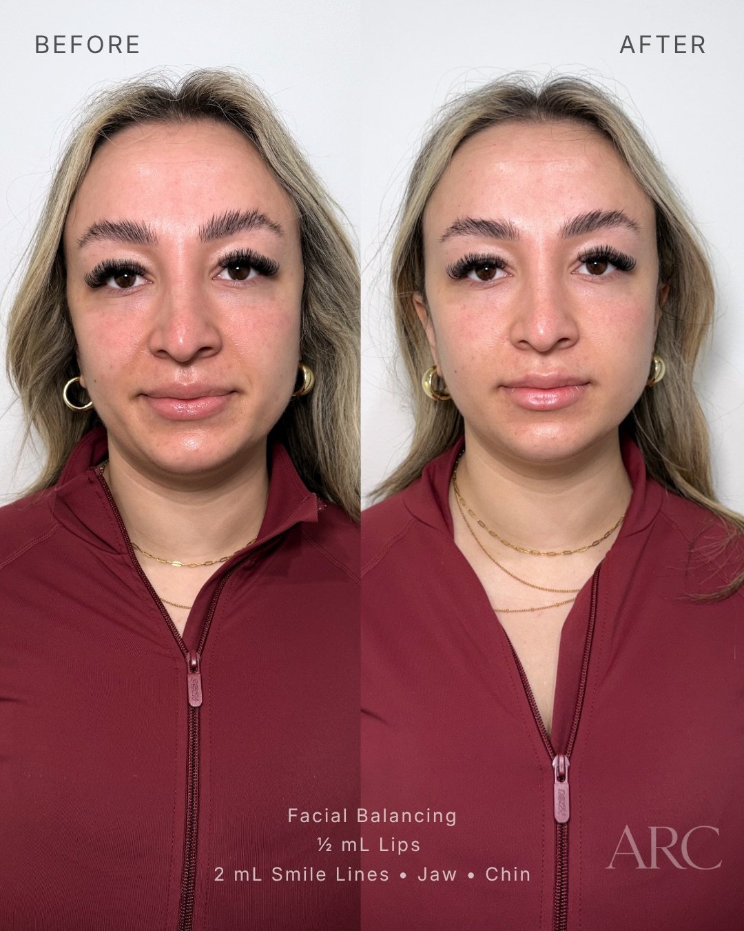 Facial Balancing