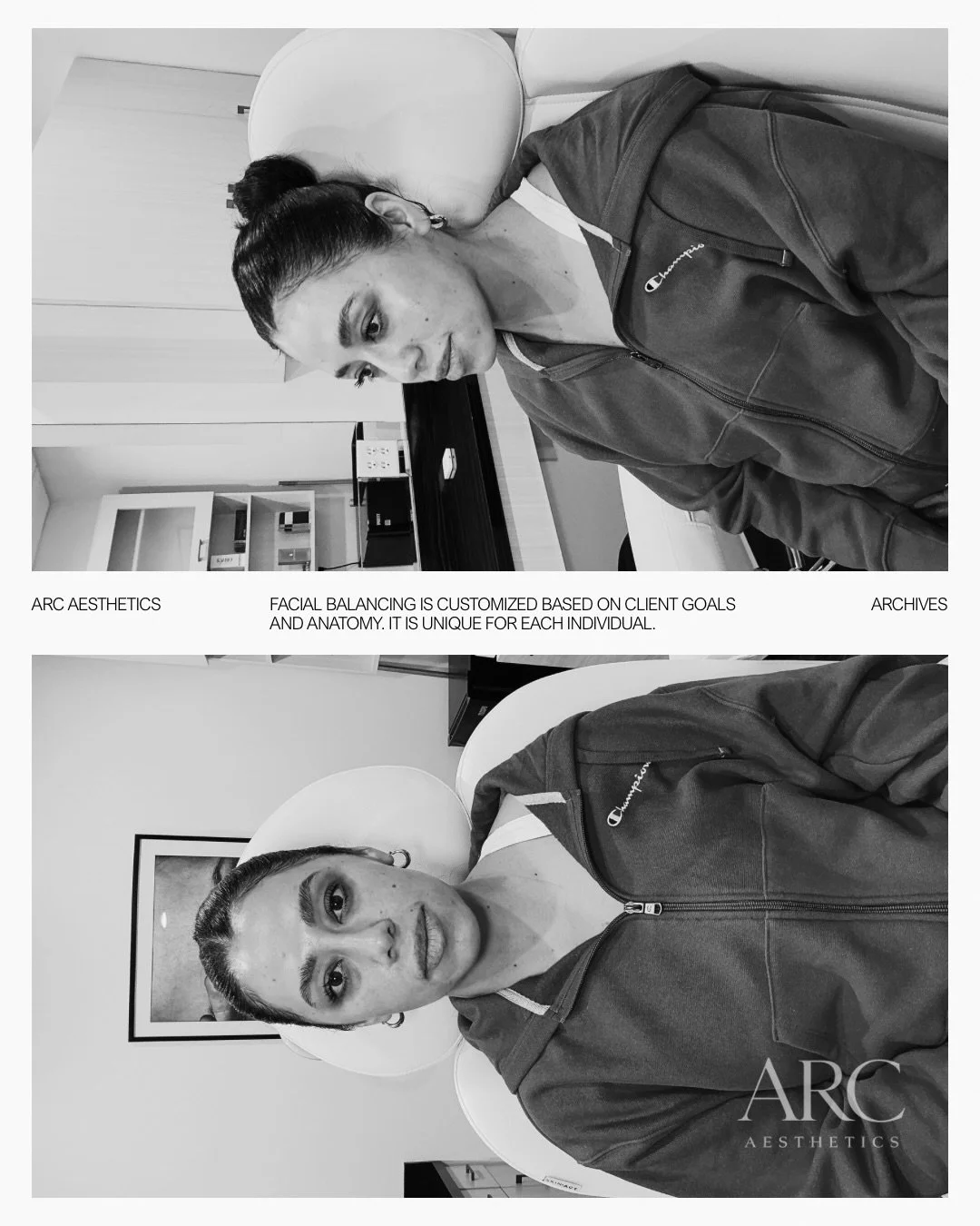 Chin. Chin shadow. Jaw. Smile lines. A little lip. 🖤 
The full picture &mdash; built for her face specifically. 
Undetectable but impactful. 
This is the work I live for. 🤍

Omaha | DNP, FNP-C | Book via link in bio

#omahafacialbalancing #omahainj