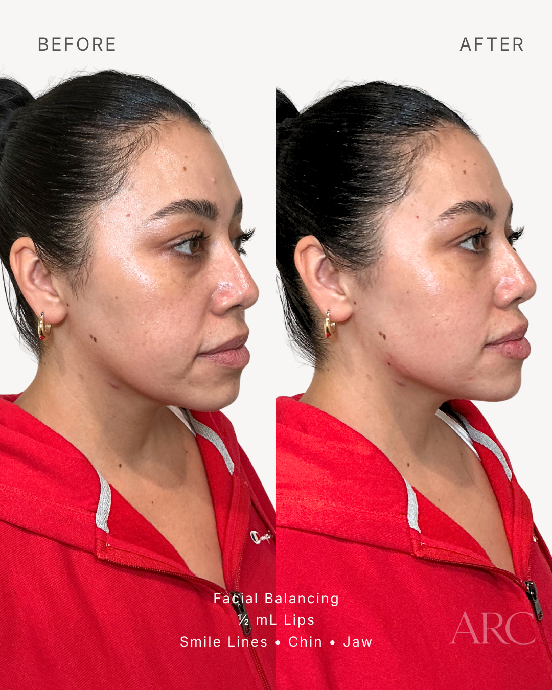 Facial Balancing